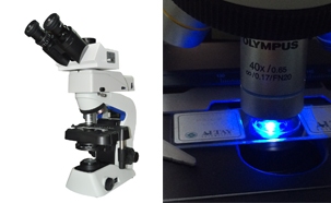 Fluorescence microscope for skin fungus research