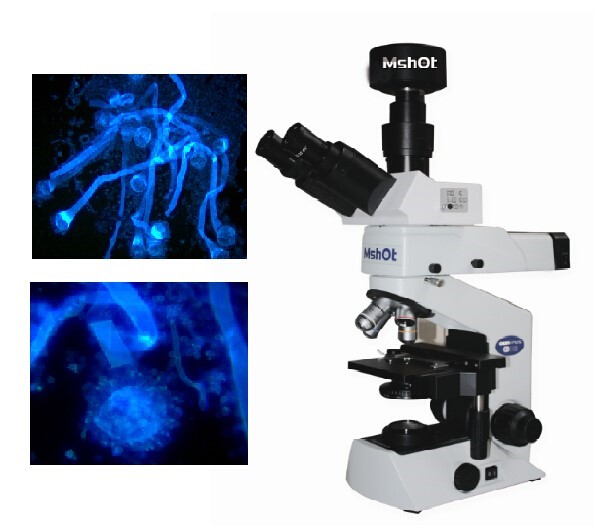 Application of UV LED fluorescence microscope in detection of fungal infection