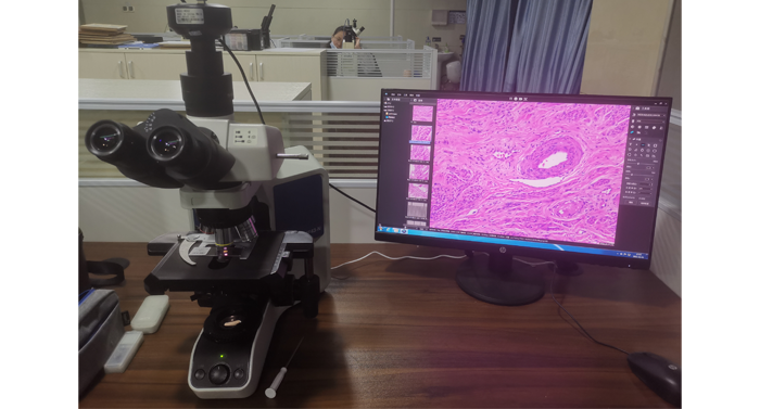 Equivalent biological microscope to Olympus BX ML51-N