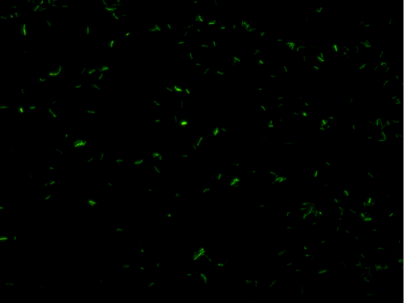 tuberculosis_led_fluorescence_microscope_mshot.png