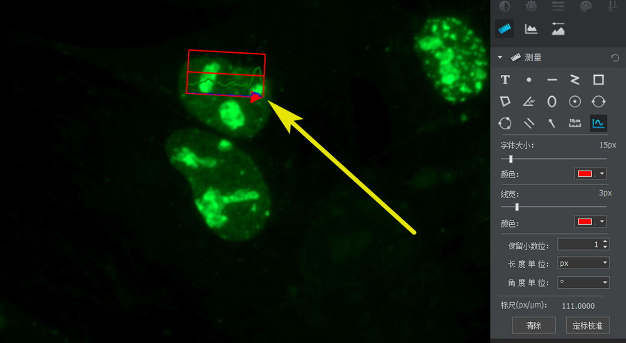 Microscope Imagej More than imageJ: How to quickly realize radial fluorescence intensity ...