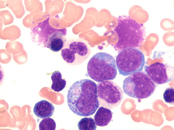 Blood Smear