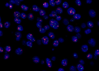 Fluorescence In Situ Hybridization(FISH)