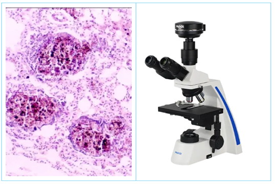 Microscopy Applications in Occupational Health Laboratories at CDC solution