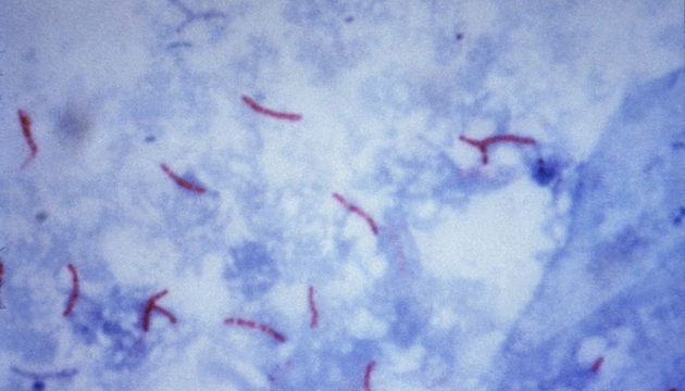 Mycobacterium tuberculosis application01