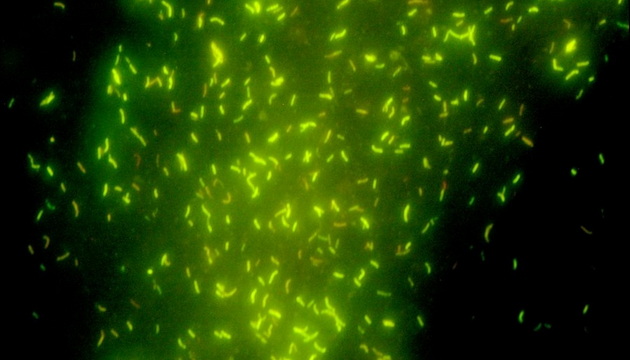 Mycobacterium tuberculosis application02
