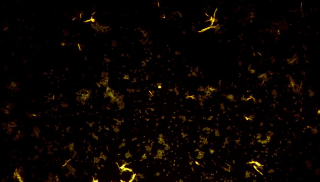 Mycobacterium tuberculosis application03
