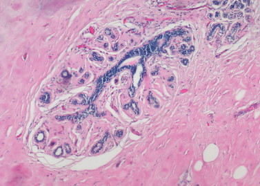 Pathological Imaging